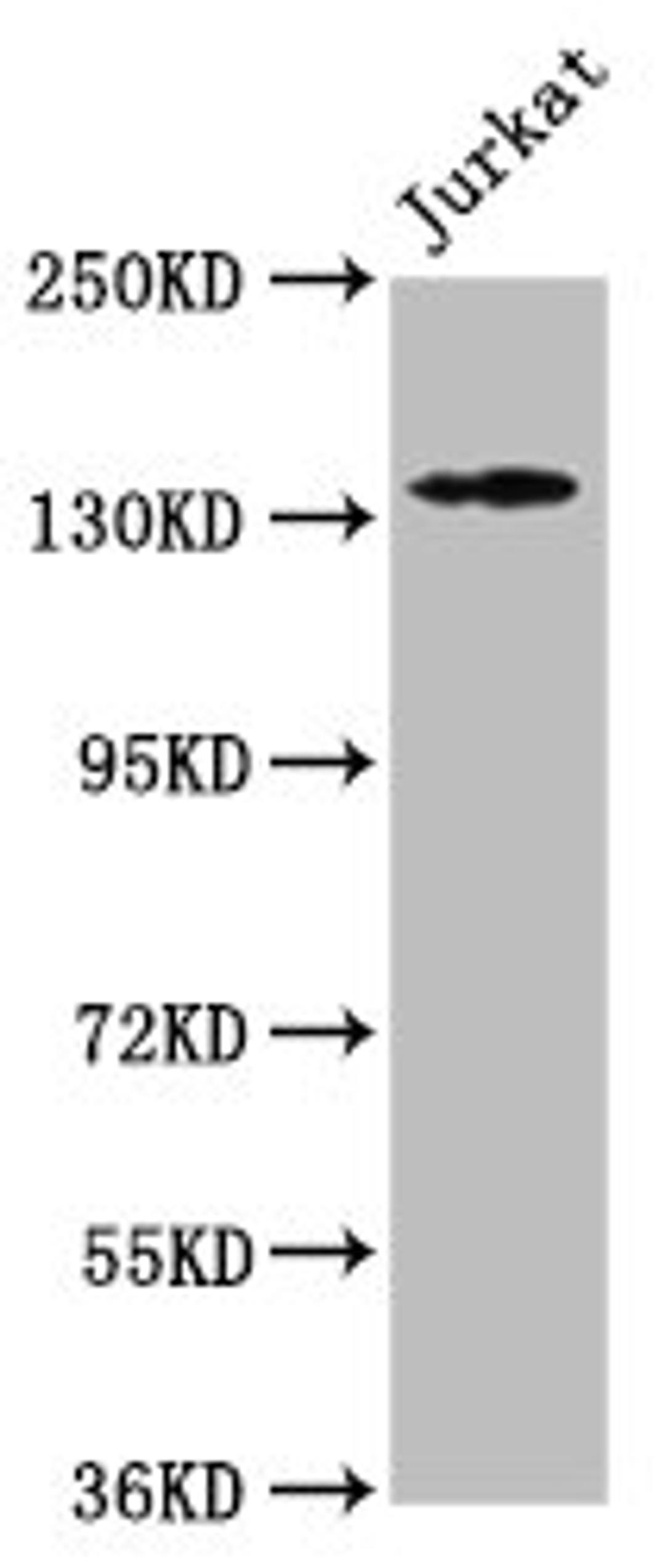 Western Blot. Positive WB detected in: Jurkat whole cell lysate. All lanes: ATP2B3 antibody at 1:500. Secondary. Goat polyclonal to rabbit IgG at 1/50000 dilution. Predicted band size: 135, 129, 128, 133, 127, 125, 123 kDa. Observed band size: 135 kDa. 