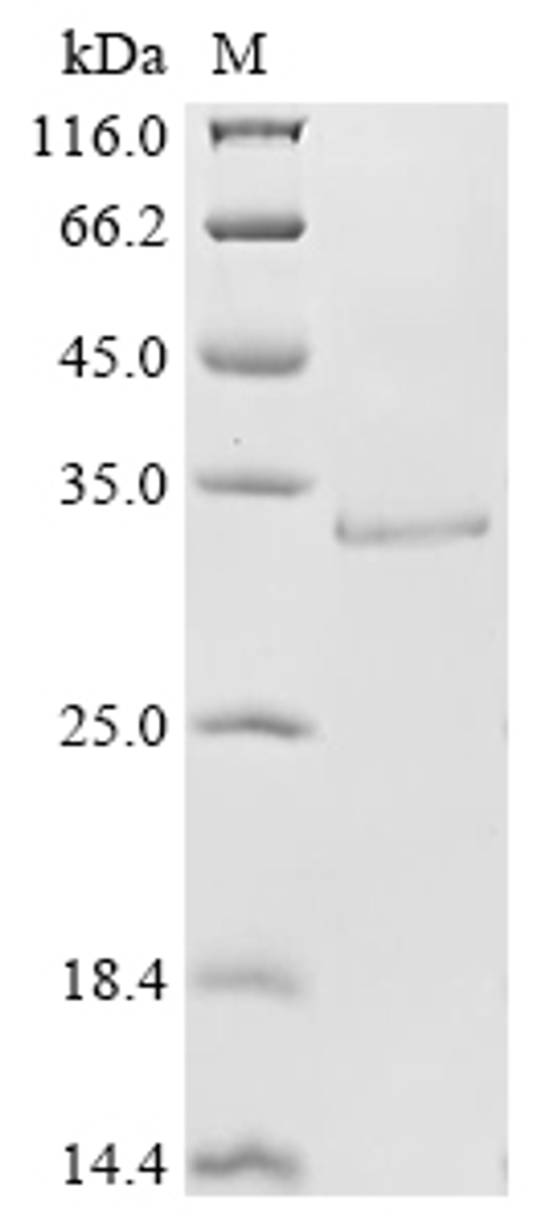 (Tris-Glycine gel) Discontinuous SDS-PAGE (reduced) with 5% enrichment gel and 15% separation gel.