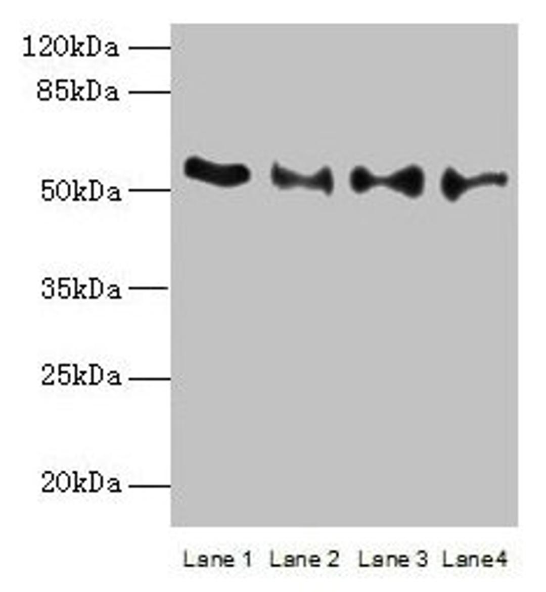 Western blot. All lanes: TRIM15 antibody at 2µg/ml. Lane 1: Jurkat whole cell lysate. Lane 2: Hela whole cell lysate. Lane 3: HepG2 whole cell lysate. Lane 4: A549 whole cell lysate. Secondary. Goat polyclonal to rabbit IgG at 1/10000 dilution. Predicted band size: 53, 13 kDa. Observed band size: 53 kDa
