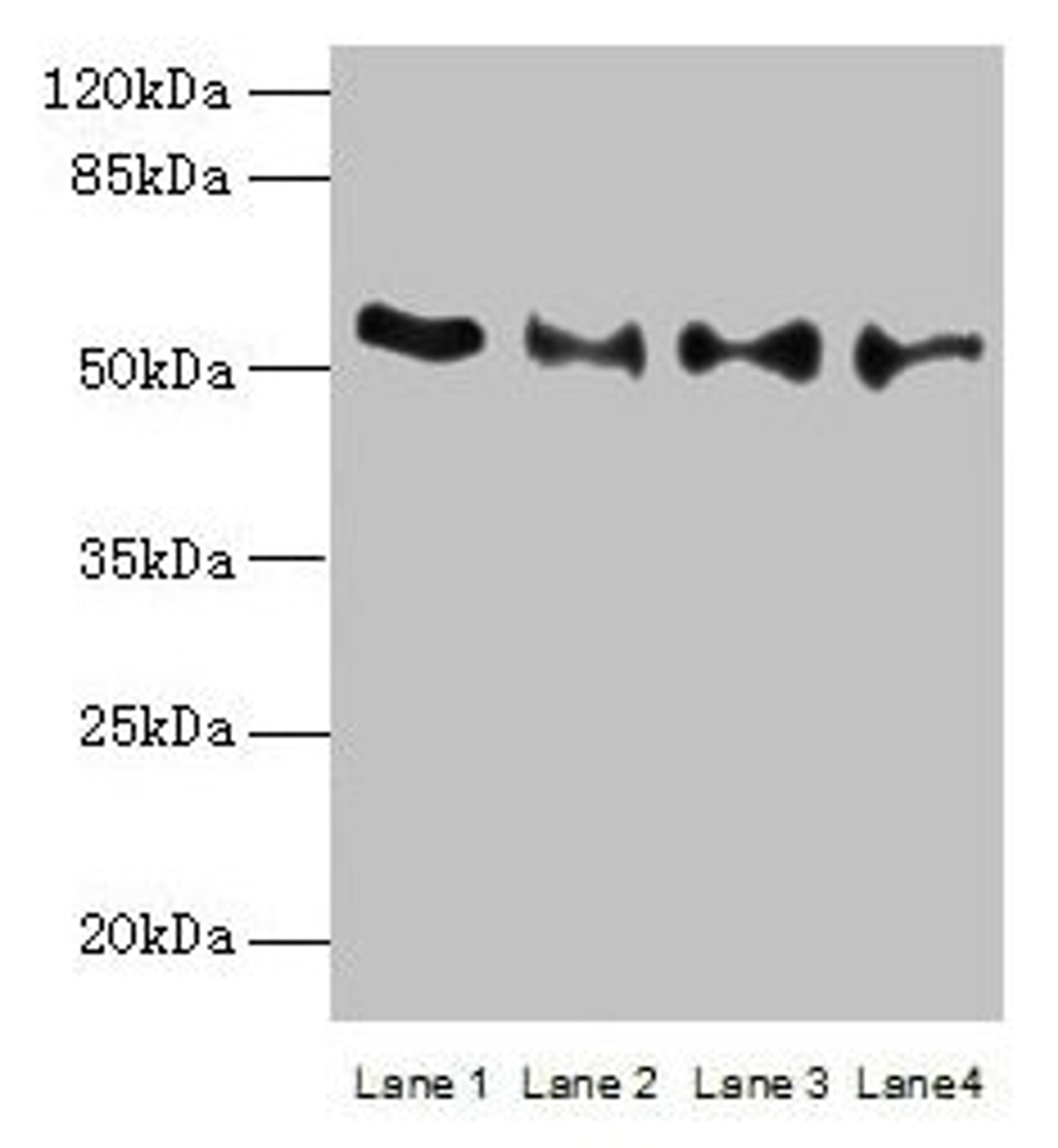 Western blot. All lanes: TRIM15 antibody at 2µg/ml. Lane 1: Jurkat whole cell lysate. Lane 2: Hela whole cell lysate. Lane 3: HepG2 whole cell lysate. Lane 4: A549 whole cell lysate. Secondary. Goat polyclonal to rabbit IgG at 1/10000 dilution. Predicted band size: 53, 13 kDa. Observed band size: 53 kDa