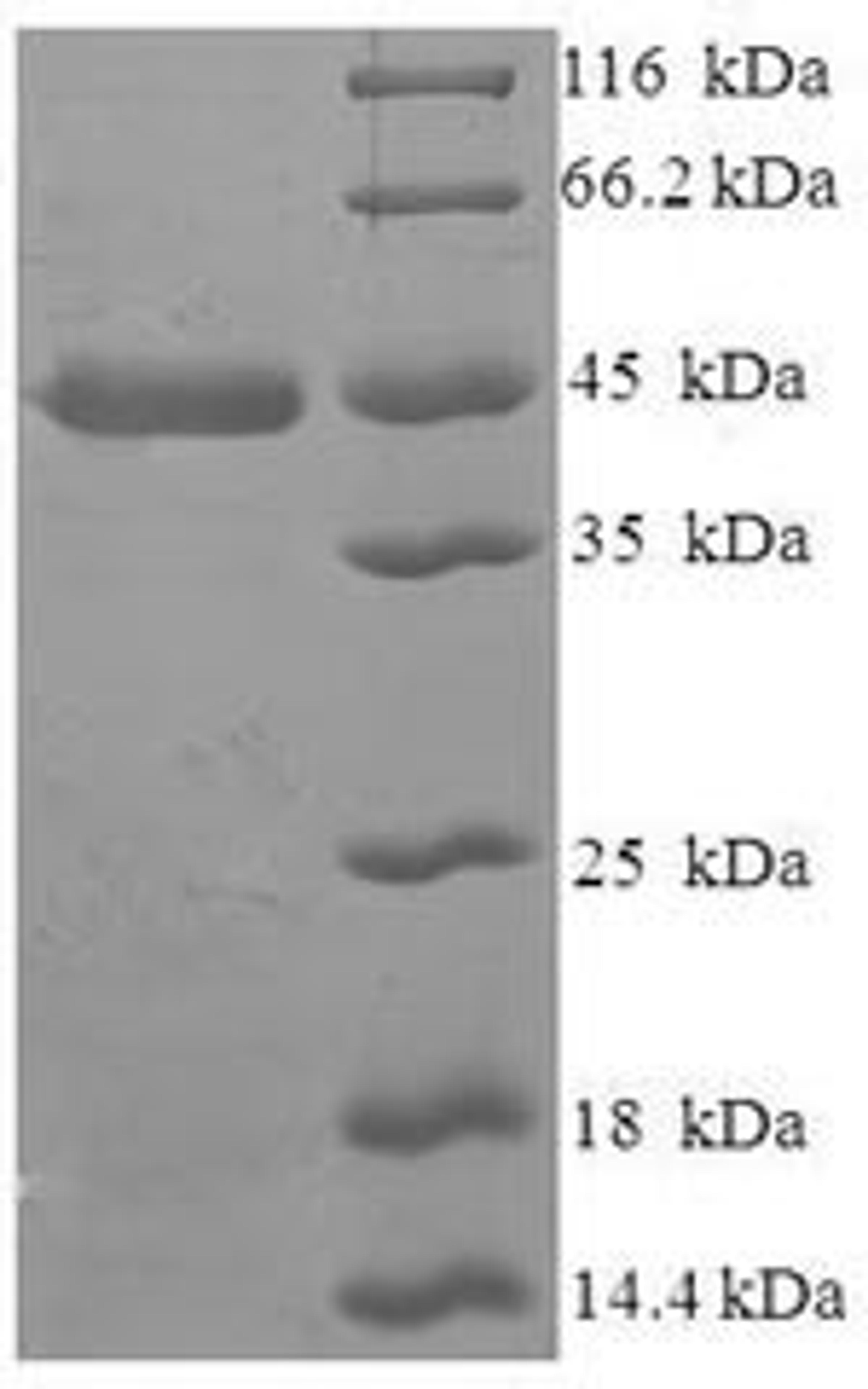 (Tris-Glycine gel) Discontinuous SDS-PAGE (reduced) with 5% enrichment gel and 15% separation gel.