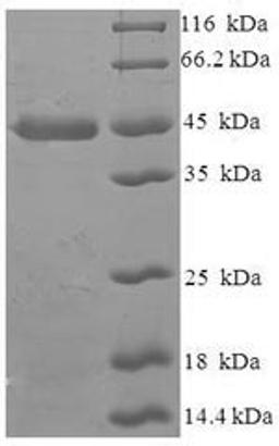 (Tris-Glycine gel) Discontinuous SDS-PAGE (reduced) with 5% enrichment gel and 15% separation gel.