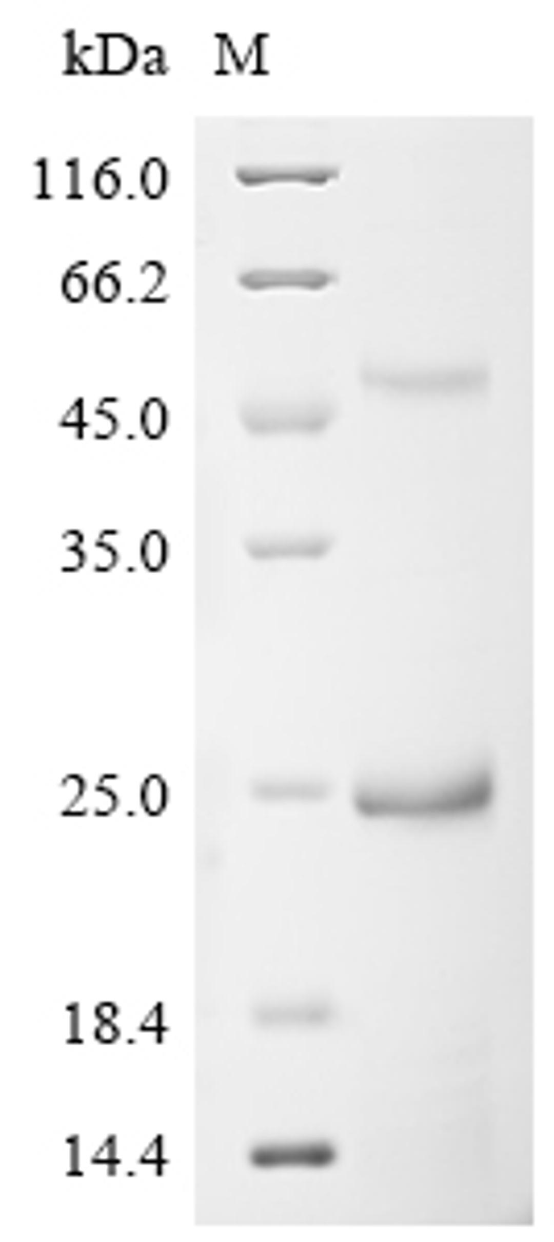 (Tris-Glycine gel) Discontinuous SDS-PAGE (reduced) with 5% enrichment gel and 15% separation gel.