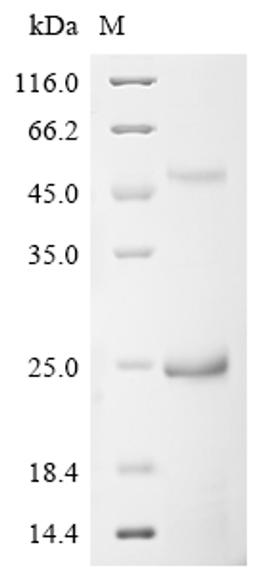 (Tris-Glycine gel) Discontinuous SDS-PAGE (reduced) with 5% enrichment gel and 15% separation gel.