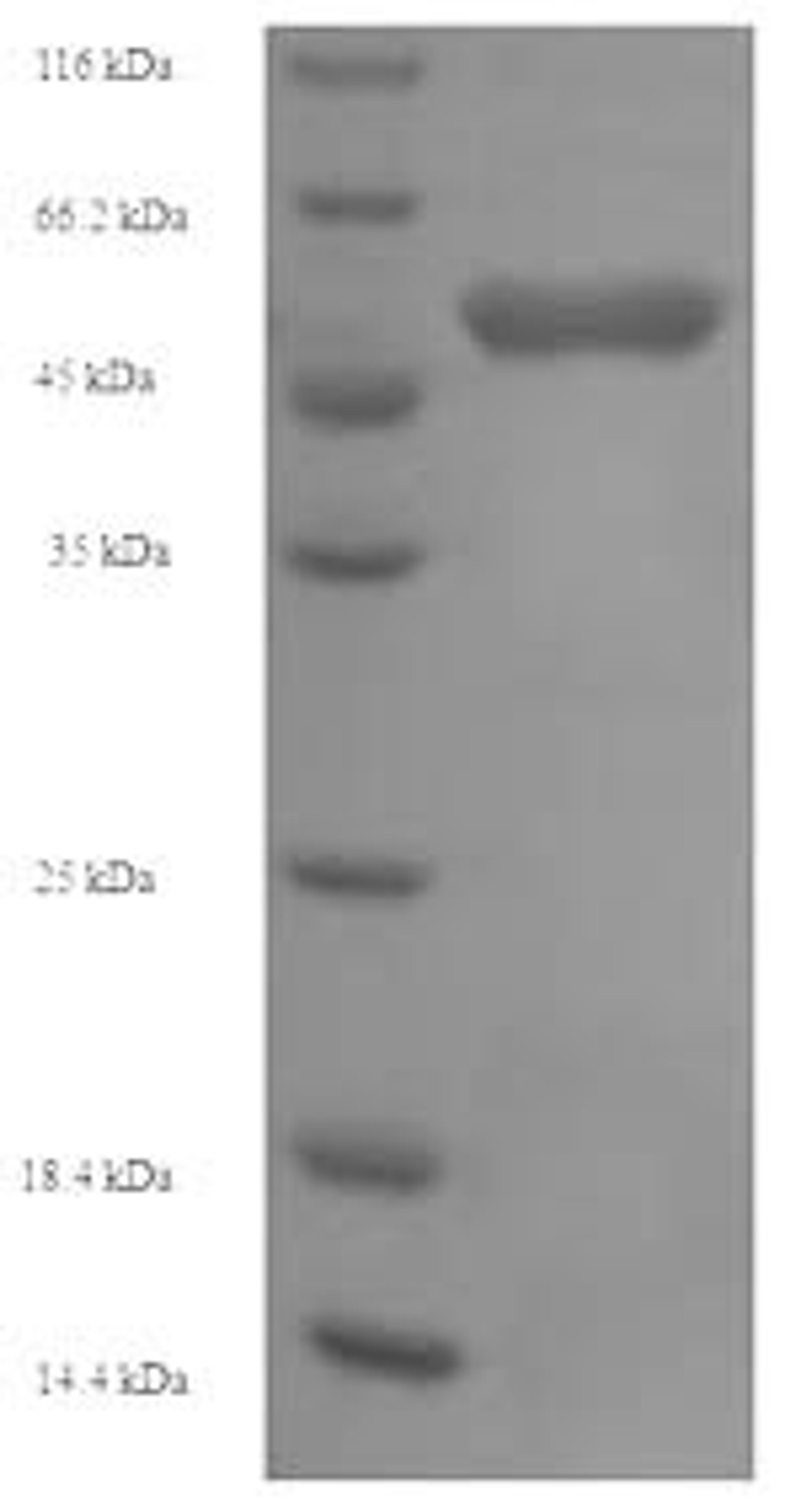 (Tris-Glycine gel) Discontinuous SDS-PAGE (reduced) with 5% enrichment gel and 15% separation gel.
