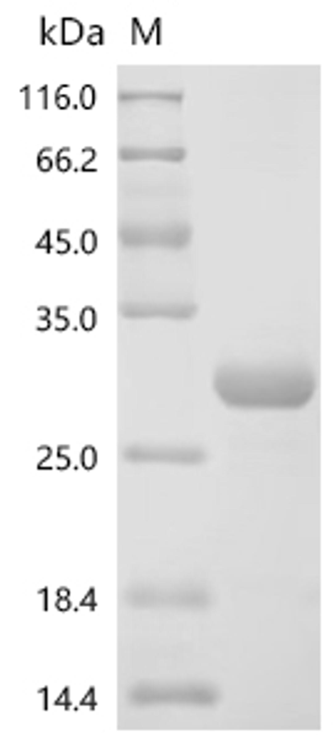 (Tris-Glycine gel) Discontinuous SDS-PAGE (reduced) with 5% enrichment gel and 15% separation gel.