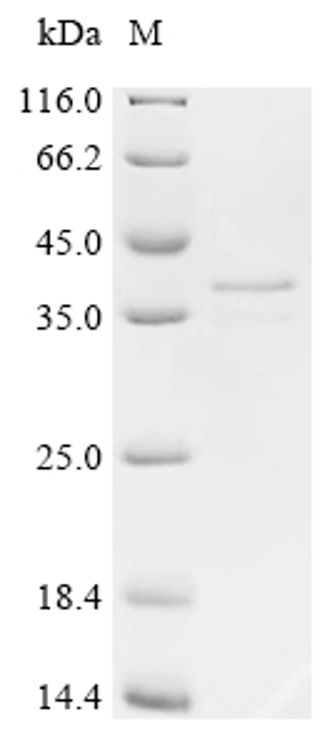 (Tris-Glycine gel) Discontinuous SDS-PAGE (reduced) with 5% enrichment gel and 15% separation gel.