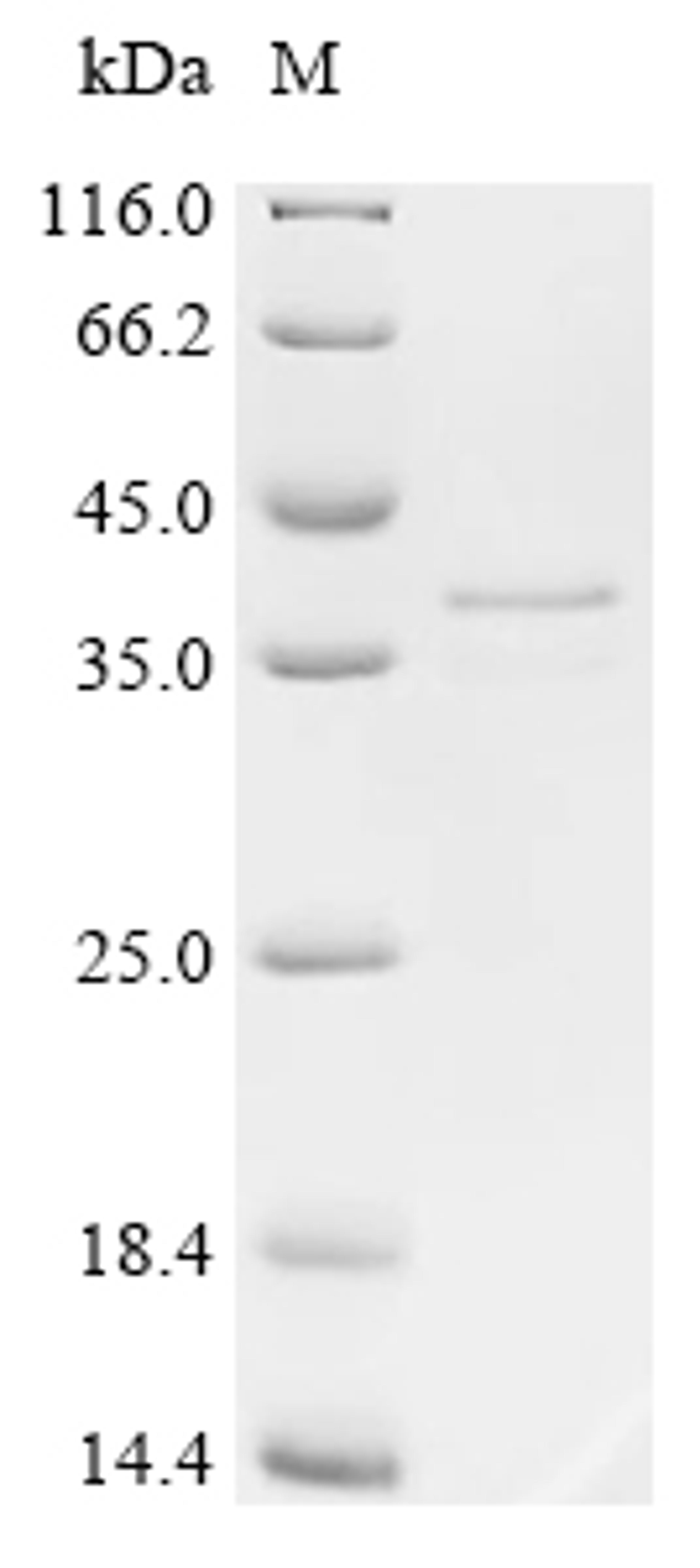(Tris-Glycine gel) Discontinuous SDS-PAGE (reduced) with 5% enrichment gel and 15% separation gel.