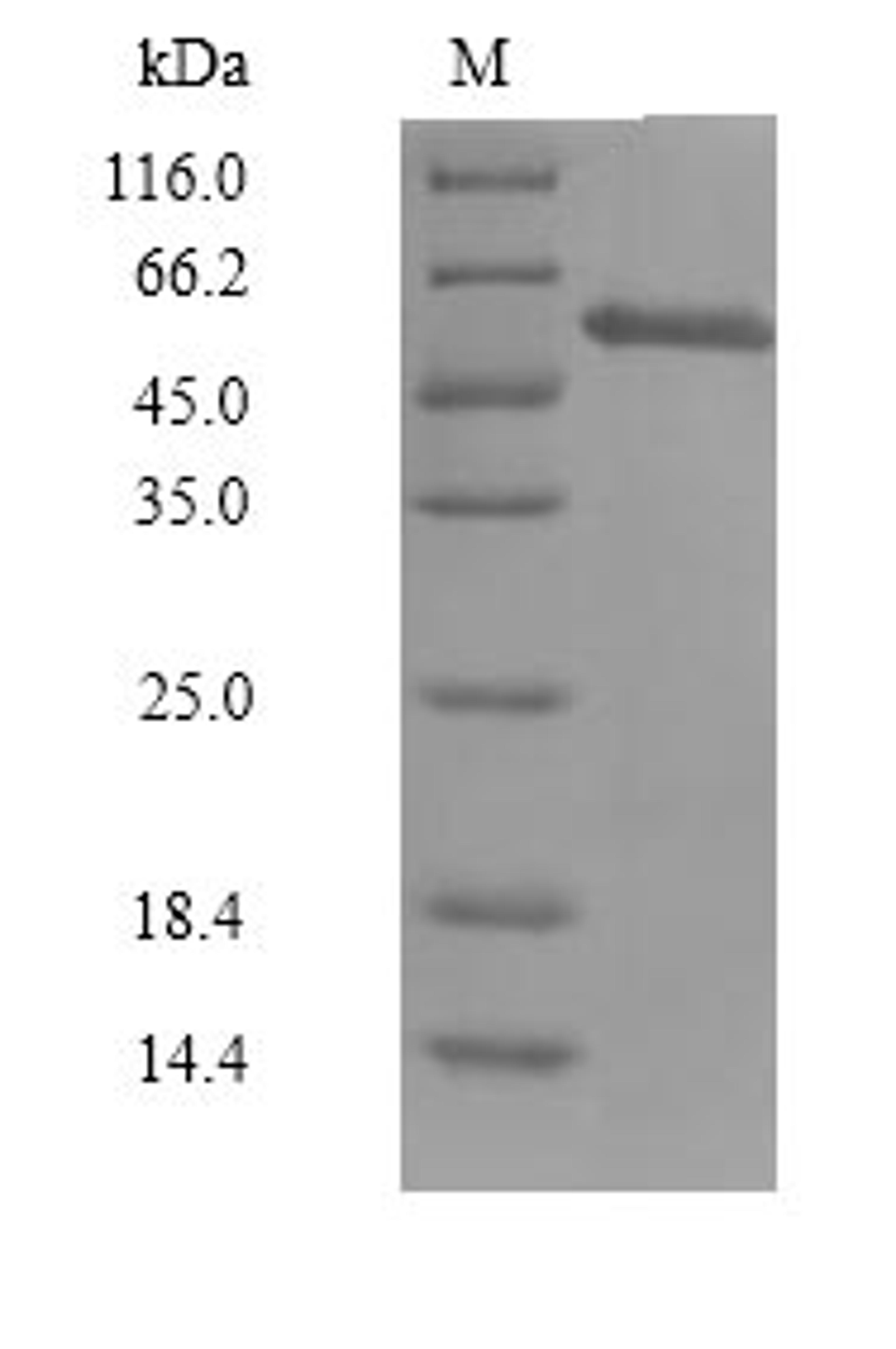 (Tris-Glycine gel) Discontinuous SDS-PAGE (reduced) with 5% enrichment gel and 15% separation gel.