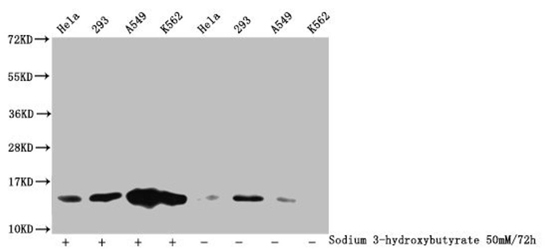 Western Blot. Detected samples: Hela whole cell lysate, 293 whole cell lysate, A549 whole cell lysate, K562 whole cell lysate; Untreated (-) or treated (+) with 50mM Sodium 3-hydroxybutyrate for 72h. All lanes: HIST1H2BC antibody at 1:100. Secondary. Goat polyclonal to rabbit IgG at 1/50000 dilution. Predicted band size: 14 kDa. Observed band size: 14 kDa