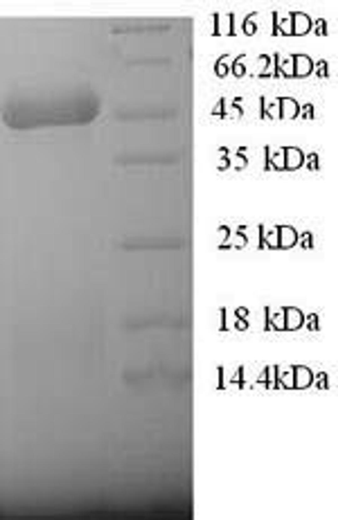 (Tris-Glycine gel) Discontinuous SDS-PAGE (reduced) with 5% enrichment gel and 15% separation gel.