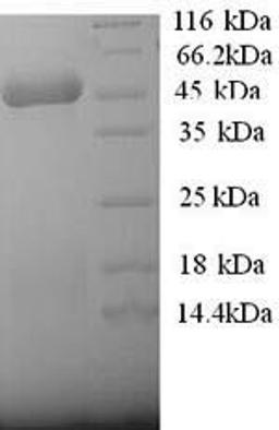 (Tris-Glycine gel) Discontinuous SDS-PAGE (reduced) with 5% enrichment gel and 15% separation gel.
