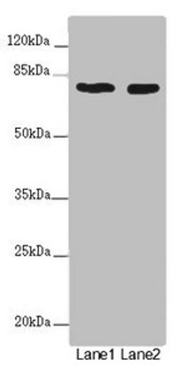 Western blot. All lanes: UVRAG antibody at 2µg/ml. Lane 1: SH-SY5Y whole cell lysate. Lane 2: 293T whole cell lysate. Secondary. Goat polyclonal to rabbit IgG at 1/10000 dilution. Predicted band size: 79, 36 kDa. Observed band size: 79 kDa
