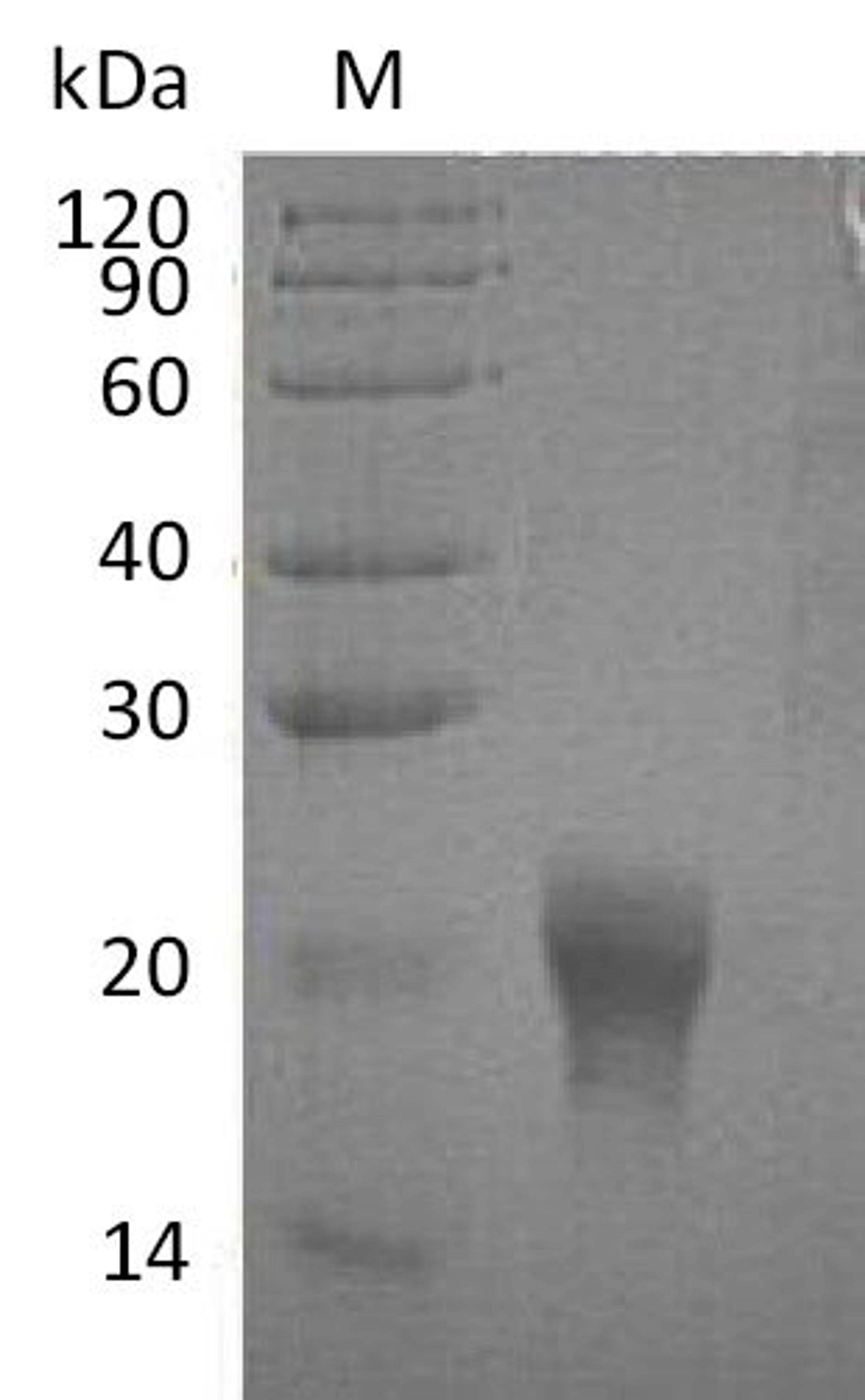 (Tris-Glycine gel) Discontinuous SDS-PAGE (reduced) with 5% enrichment gel and 15% separation gel.