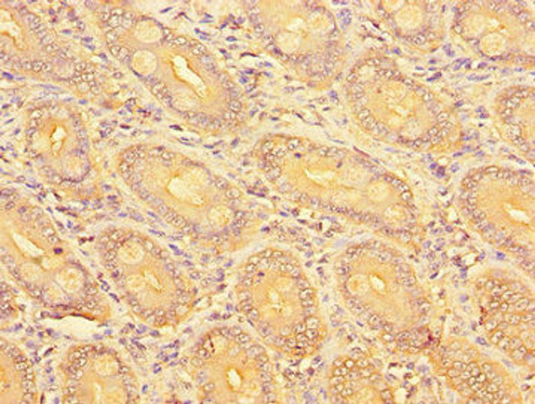Immunohistochemistry of paraffin-embedded human small intestine tissue using CSB-PA768212LA01HU at dilution of 1:100