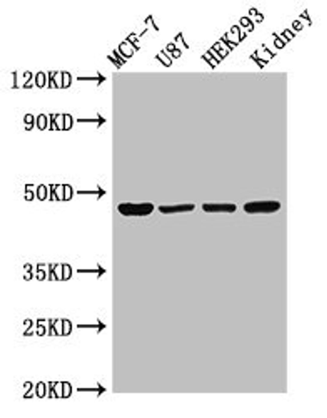 Western Blot. Positive WB detected in: MCF-7 whole cell lysate, U87 whole cell lysate, HEK293 whole cell lysate, Rat kidney tissue. All lanes: WWOX antibody at 3µg/ml. Secondary. Goat polyclonal to rabbit IgG at 1/50000 dilution. Predicted band size: 47, 42, 22, 5, 27, 36, 24 kDa. Observed band size: 47 kDa