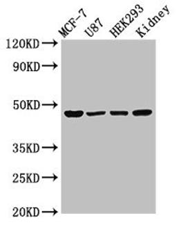 Western Blot. Positive WB detected in: MCF-7 whole cell lysate, U87 whole cell lysate, HEK293 whole cell lysate, Rat kidney tissue. All lanes: WWOX antibody at 3µg/ml. Secondary. Goat polyclonal to rabbit IgG at 1/50000 dilution. Predicted band size: 47, 42, 22, 5, 27, 36, 24 kDa. Observed band size: 47 kDa