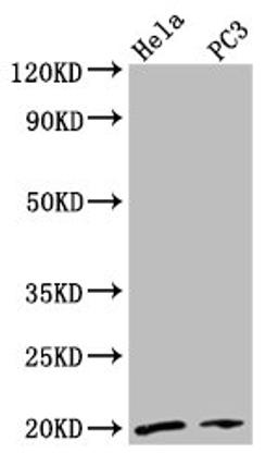 Western Blot. Positive WB detected in: Hela whole cell lysate, PC-3 whole cell lysate. All lanes: NDUFAF2 antibody at 2.7µg/ml. Secondary. Goat polyclonal to rabbit IgG at 1/50000 dilution. Predicted band size: 20 kDa. Observed band size: 20 kDa