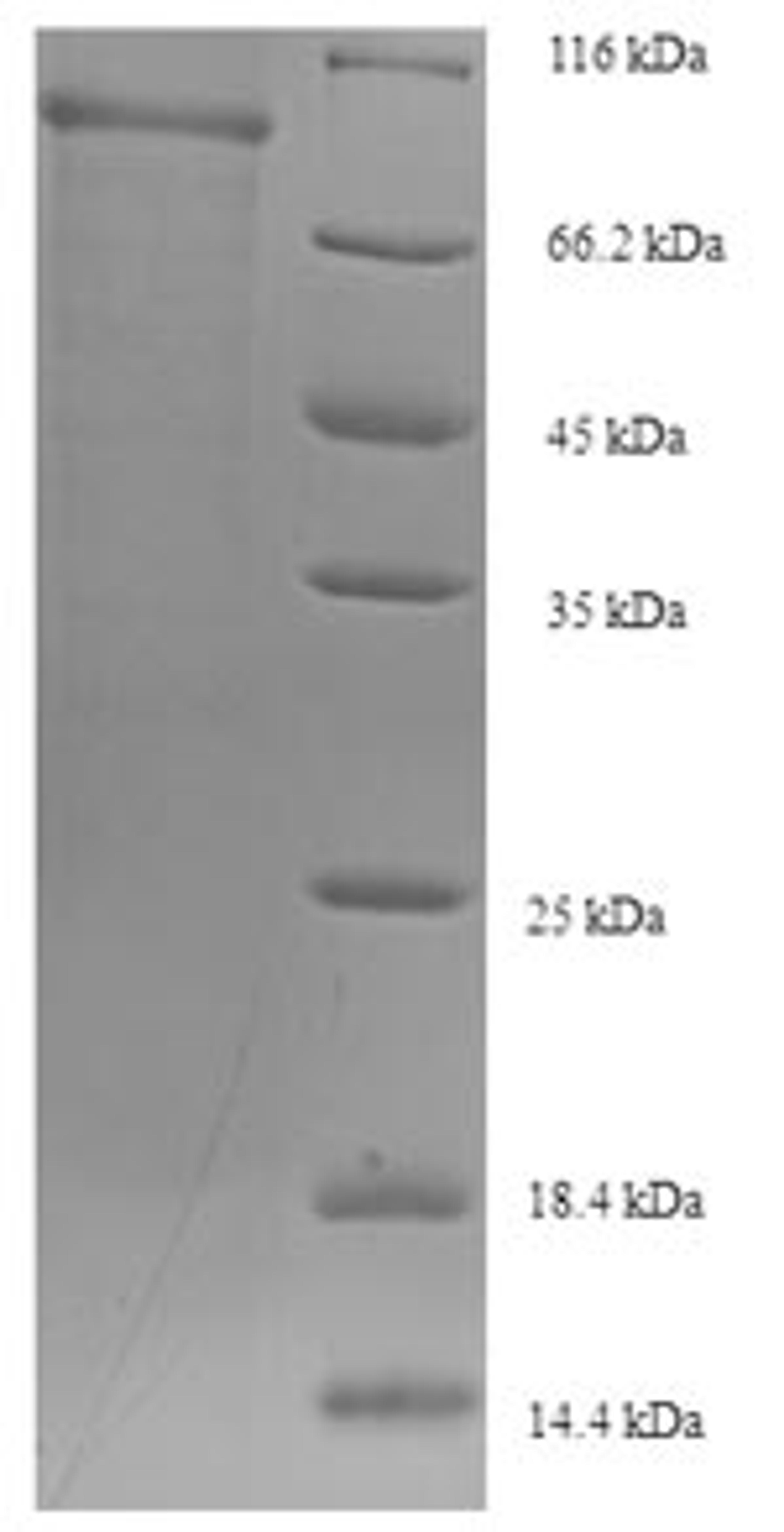 (Tris-Glycine gel) Discontinuous SDS-PAGE (reduced) with 5% enrichment gel and 15% separation gel.