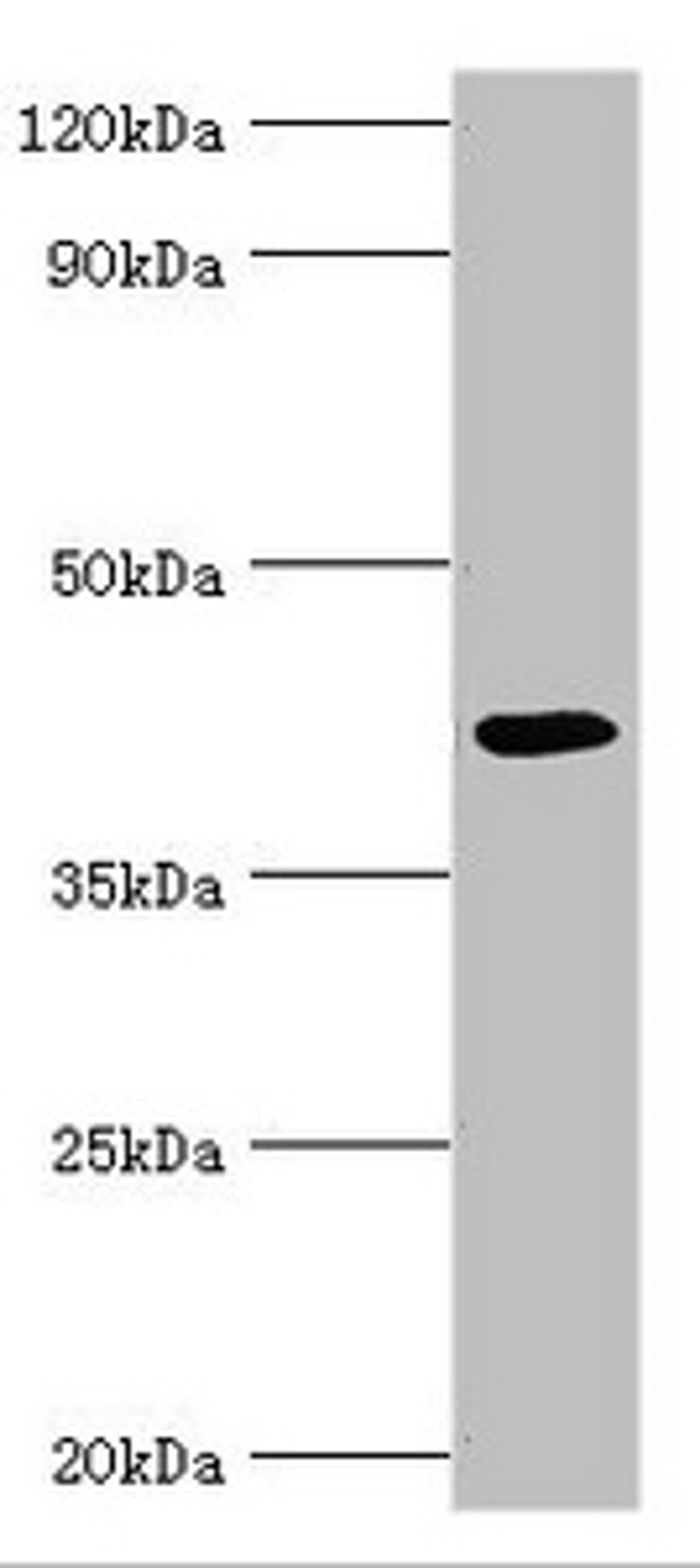 Western blot. All lanes: Alkylated DNA repair protein alkB homolog 1 antibody at 9ug/ml + Mouse kidney tissue. Secondary. Goat polyclonal to rabbit IgG at 1/10000 dilution. Predicted band size: 44 kDa. Observed band size: 44 kDa. 