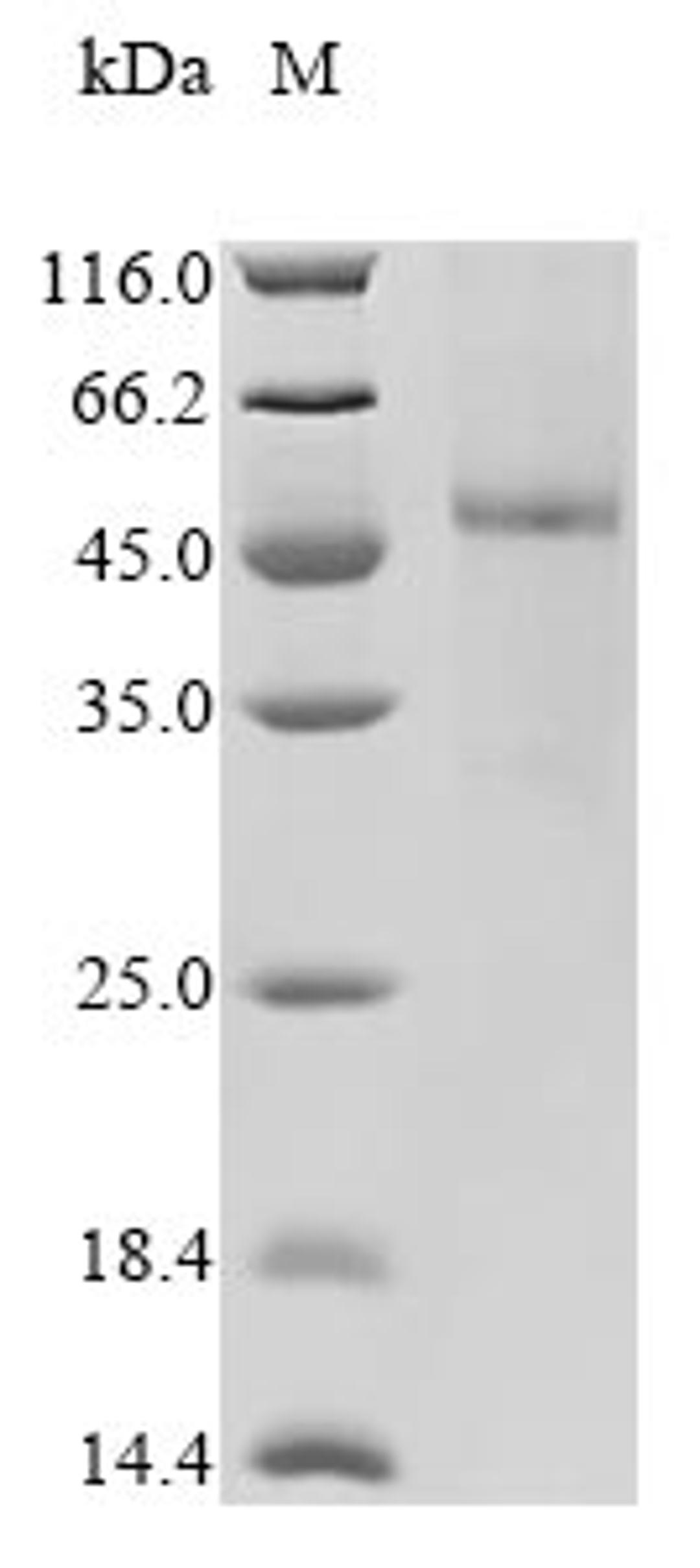 (Tris-Glycine gel) Discontinuous SDS-PAGE (reduced) with 5% enrichment gel and 15% separation gel.