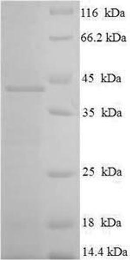 (Tris-Glycine gel) Discontinuous SDS-PAGE (reduced) with 5% enrichment gel and 15% separation gel.