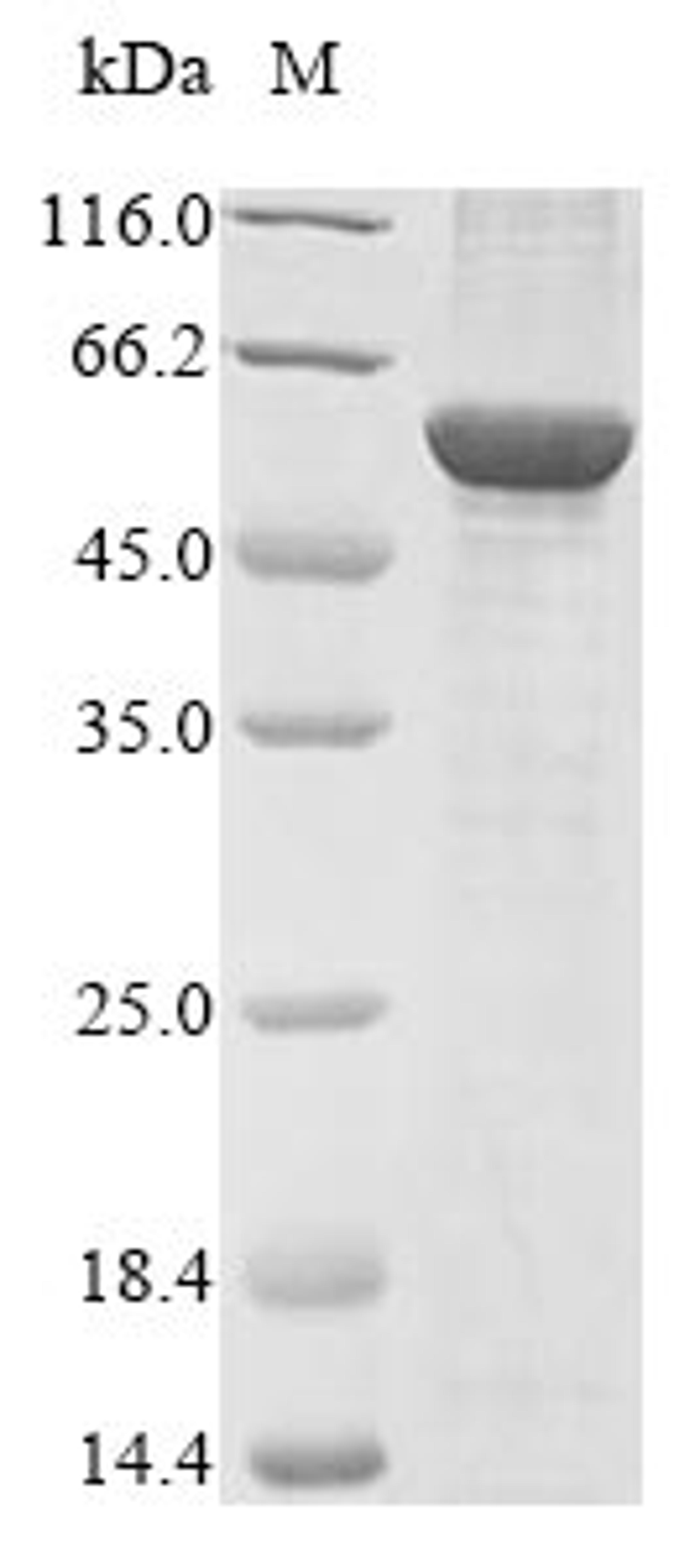 (Tris-Glycine gel) Discontinuous SDS-PAGE (reduced) with 5% enrichment gel and 15% separation gel.