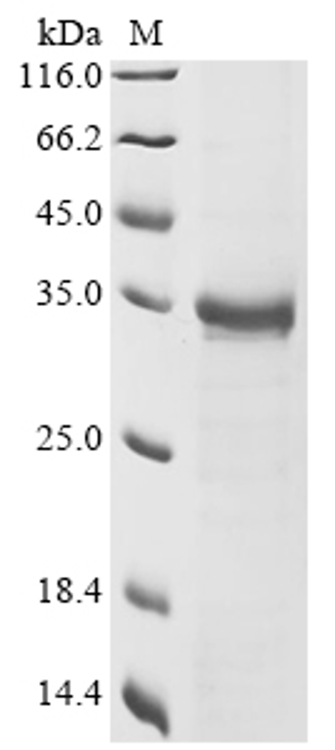 (Tris-Glycine gel) Discontinuous SDS-PAGE (reduced) with 5% enrichment gel and 15% separation gel.
