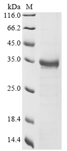 (Tris-Glycine gel) Discontinuous SDS-PAGE (reduced) with 5% enrichment gel and 15% separation gel.