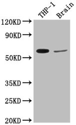 Western Blot. Positive WB detected in: THP-1 whole cell lysate, Rat brain tissue. All lanes: COL9A2 antibody at 1:2000. Secondary. Goat polyclonal to rabbit IgG at 1/50000 dilution. Predicted band size: 66 kDa. Observed band size: 66 kDa