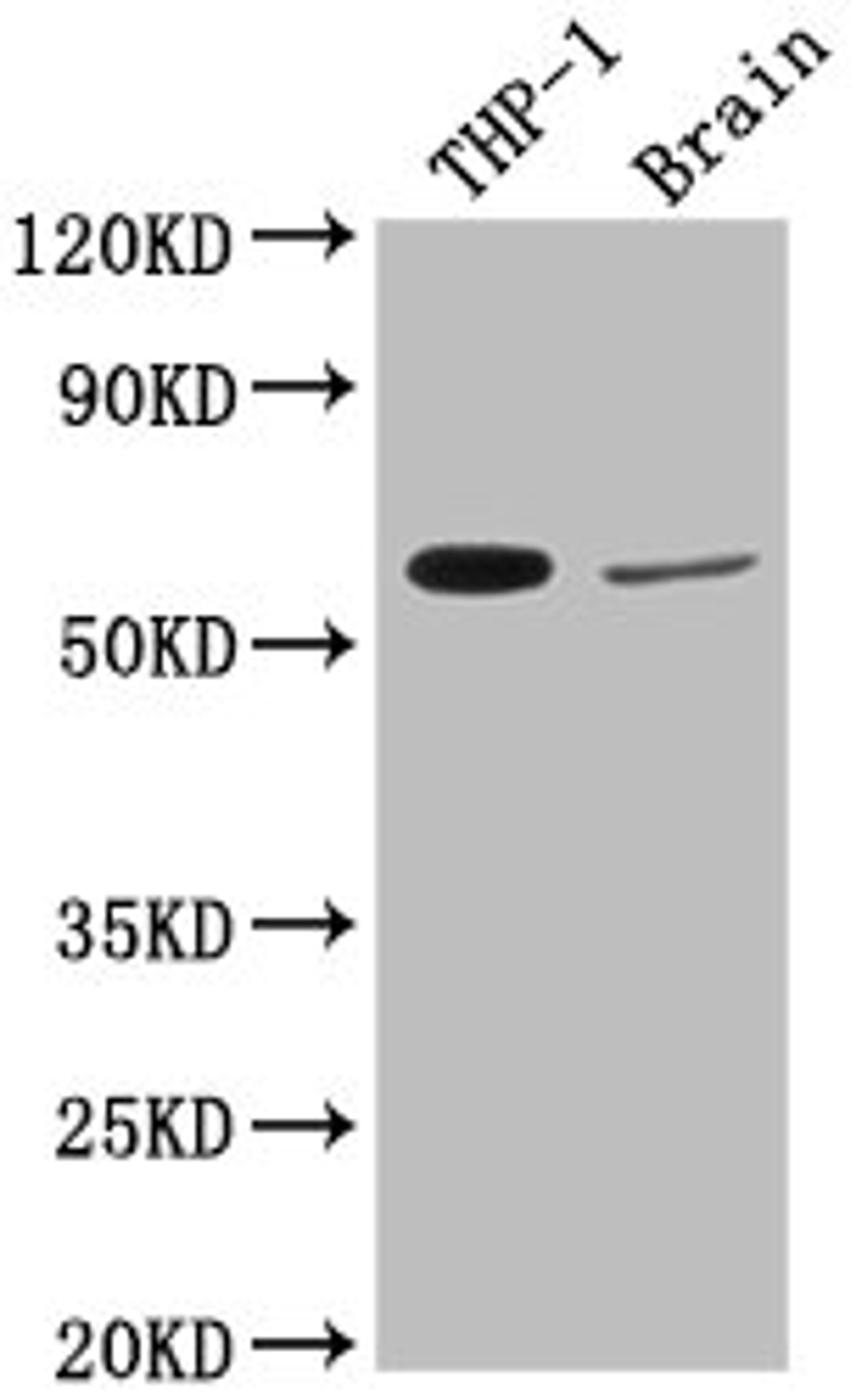 Western Blot. Positive WB detected in: THP-1 whole cell lysate, Rat brain tissue. All lanes: COL9A2 antibody at 1:2000. Secondary. Goat polyclonal to rabbit IgG at 1/50000 dilution. Predicted band size: 66 kDa. Observed band size: 66 kDa