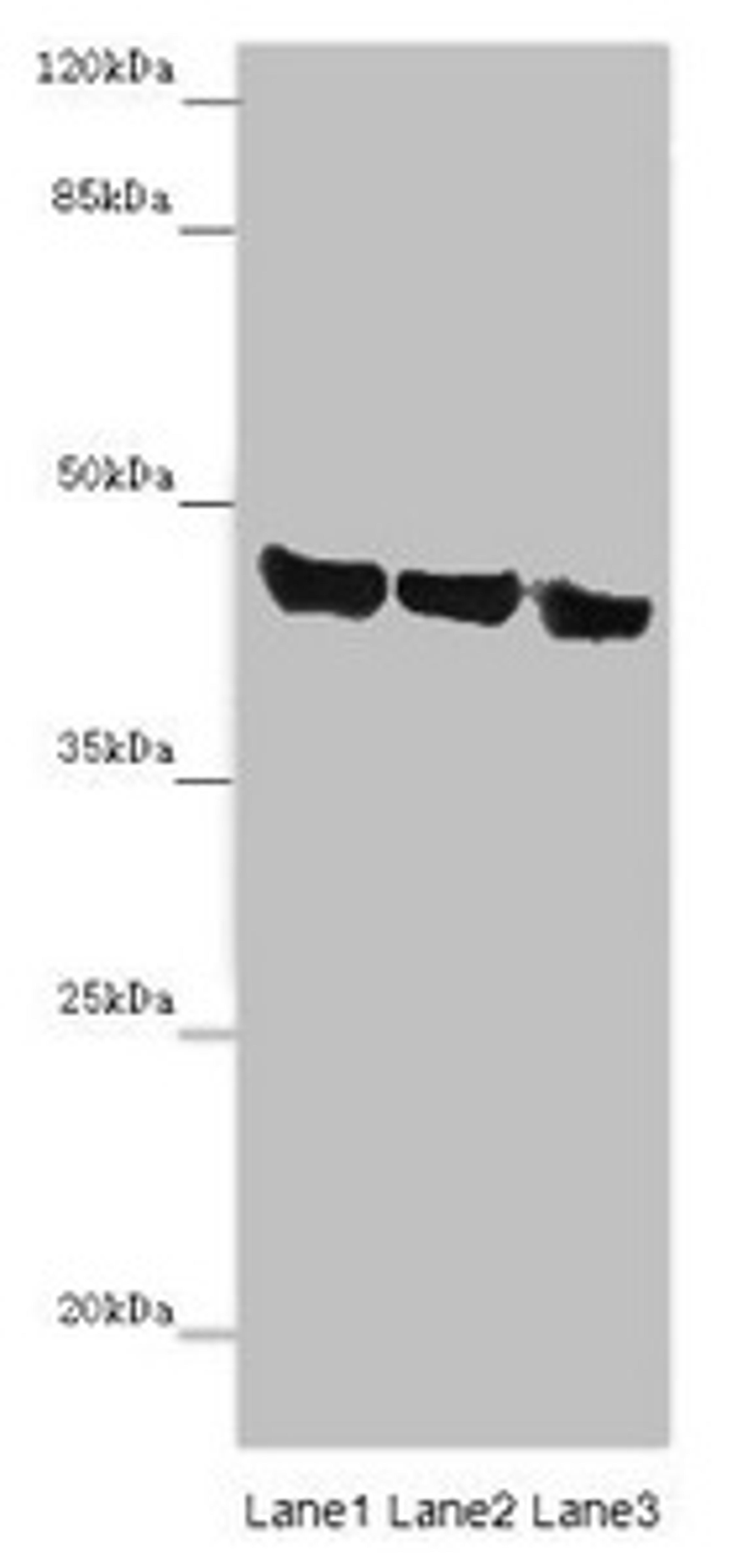 Western blot. All lanes: ASPN antibody at 14 ug/ml. Lane 1: Mouse heart tissue. Lane 2: Mouse liver tissue. Lane 3: HL60 whole cell lysate. Secondary. Goat polyclonal to rabbit IgG at 1/10000 dilution. Predicted band size: 43 kDa. Observed band size: 43 kDa. 