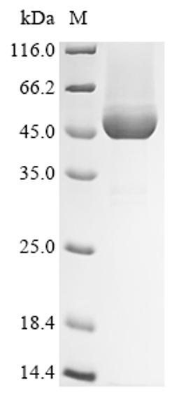 (Tris-Glycine gel) Discontinuous SDS-PAGE (reduced) with 5% enrichment gel and 15% separation gel.