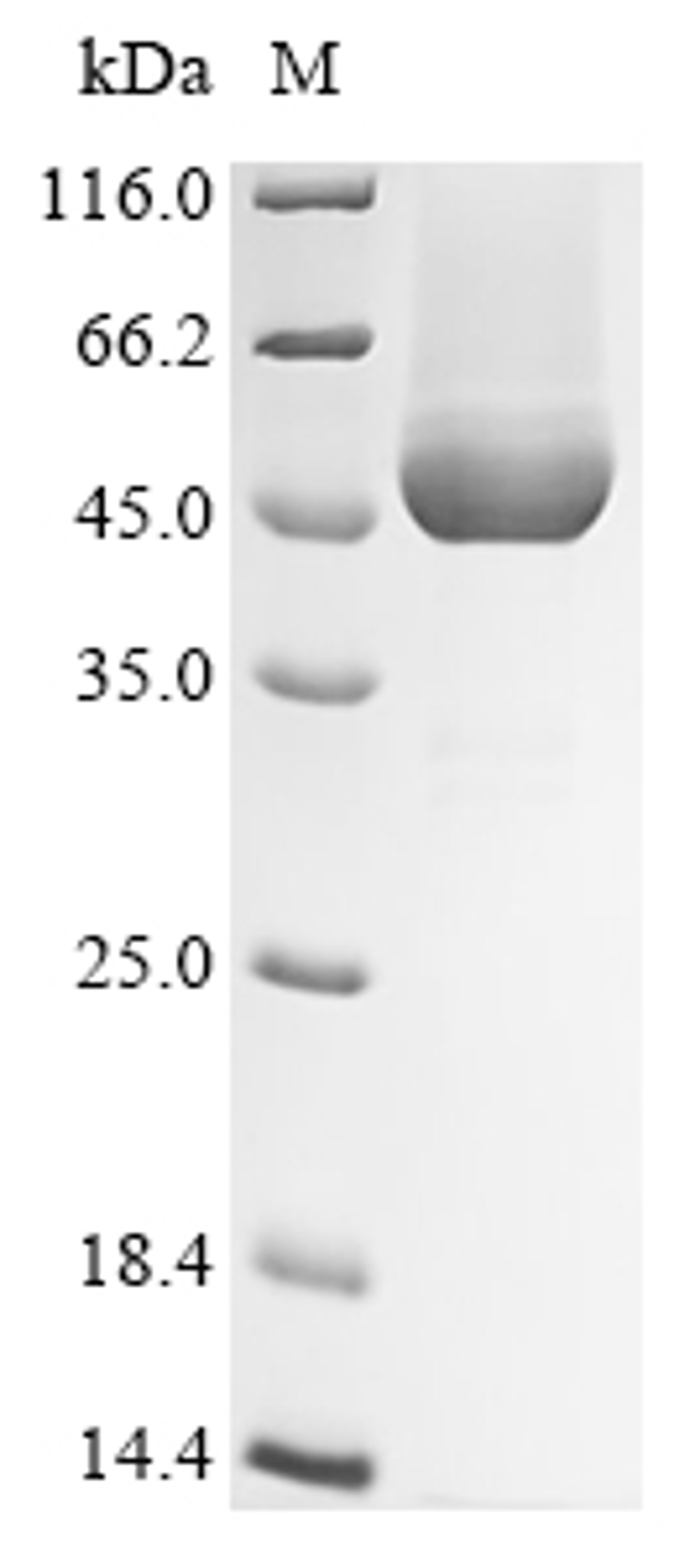 (Tris-Glycine gel) Discontinuous SDS-PAGE (reduced) with 5% enrichment gel and 15% separation gel.