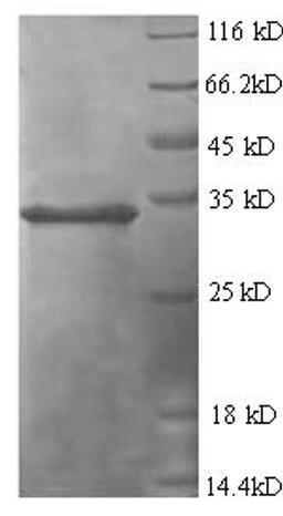 (Tris-Glycine gel) Discontinuous SDS-PAGE (reduced) with 5% enrichment gel and 15% separation gel.