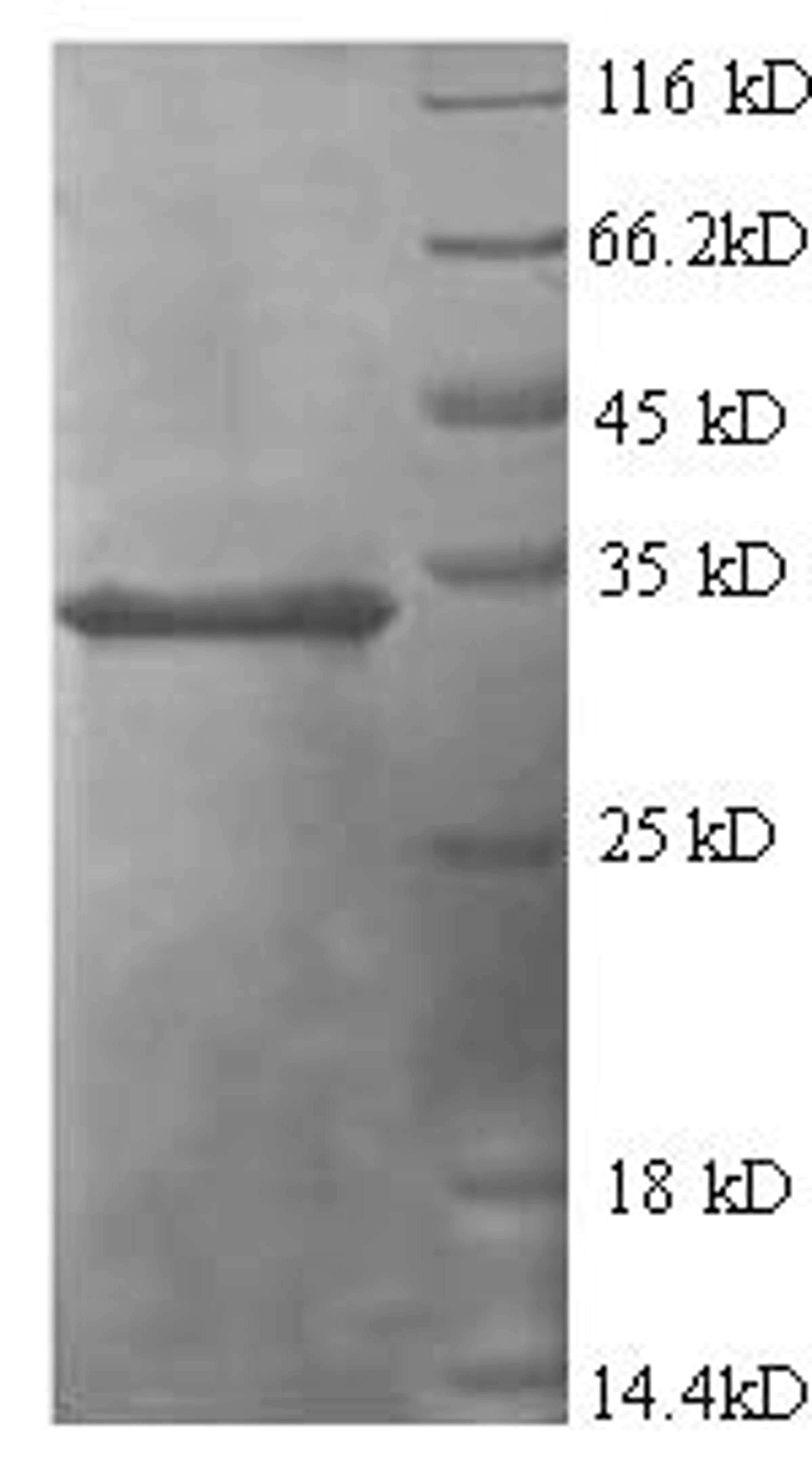 (Tris-Glycine gel) Discontinuous SDS-PAGE (reduced) with 5% enrichment gel and 15% separation gel.
