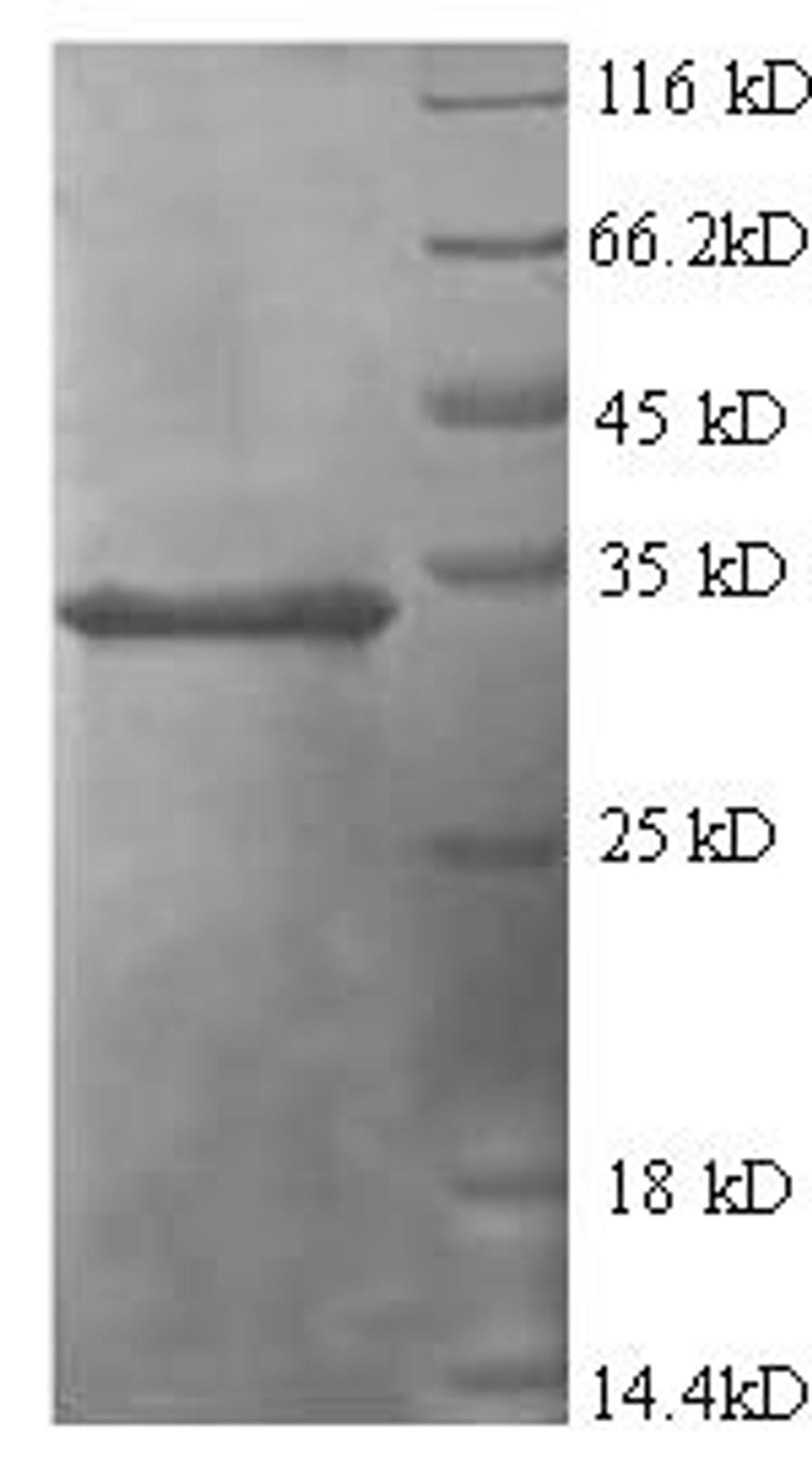 (Tris-Glycine gel) Discontinuous SDS-PAGE (reduced) with 5% enrichment gel and 15% separation gel.