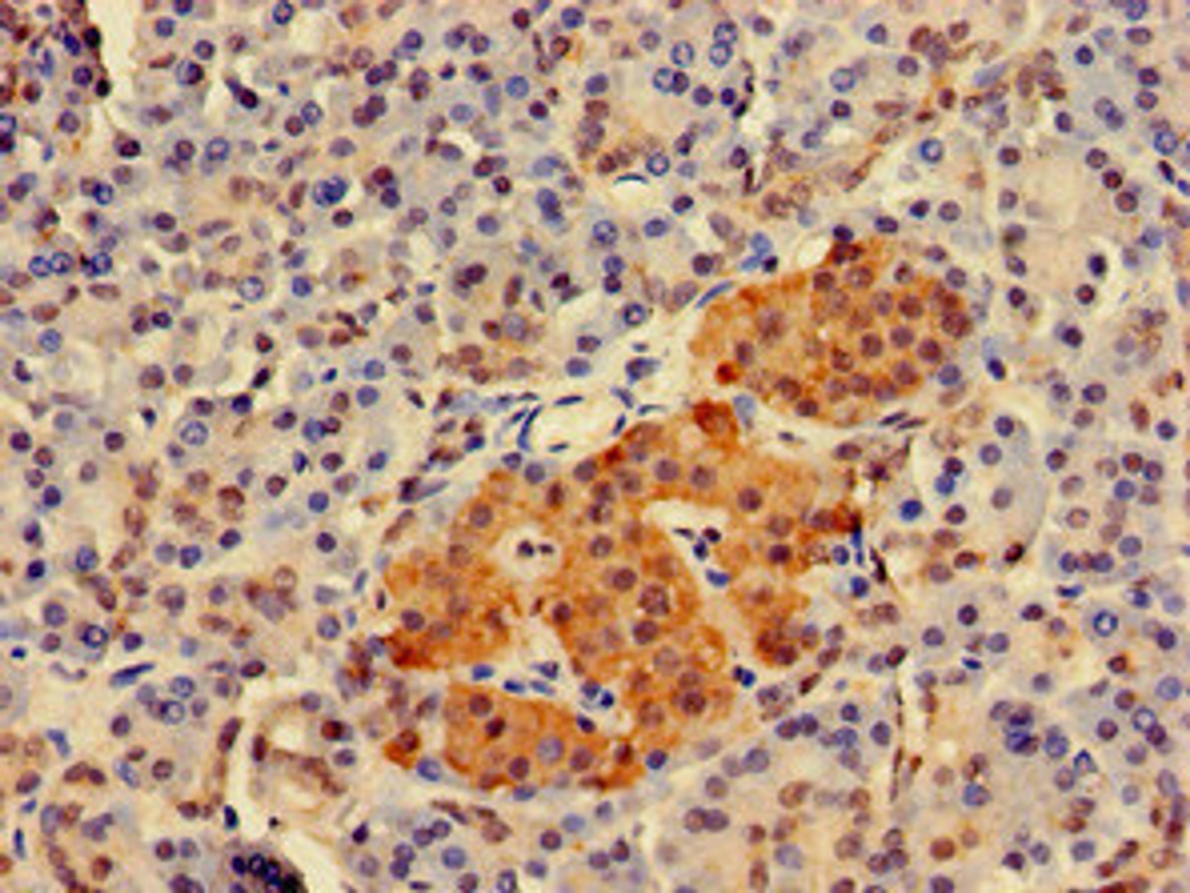 Immunohistochemistry of paraffin-embedded human pancreatic tissue using CSB-PA622511LA01HU at dilution of 1:100