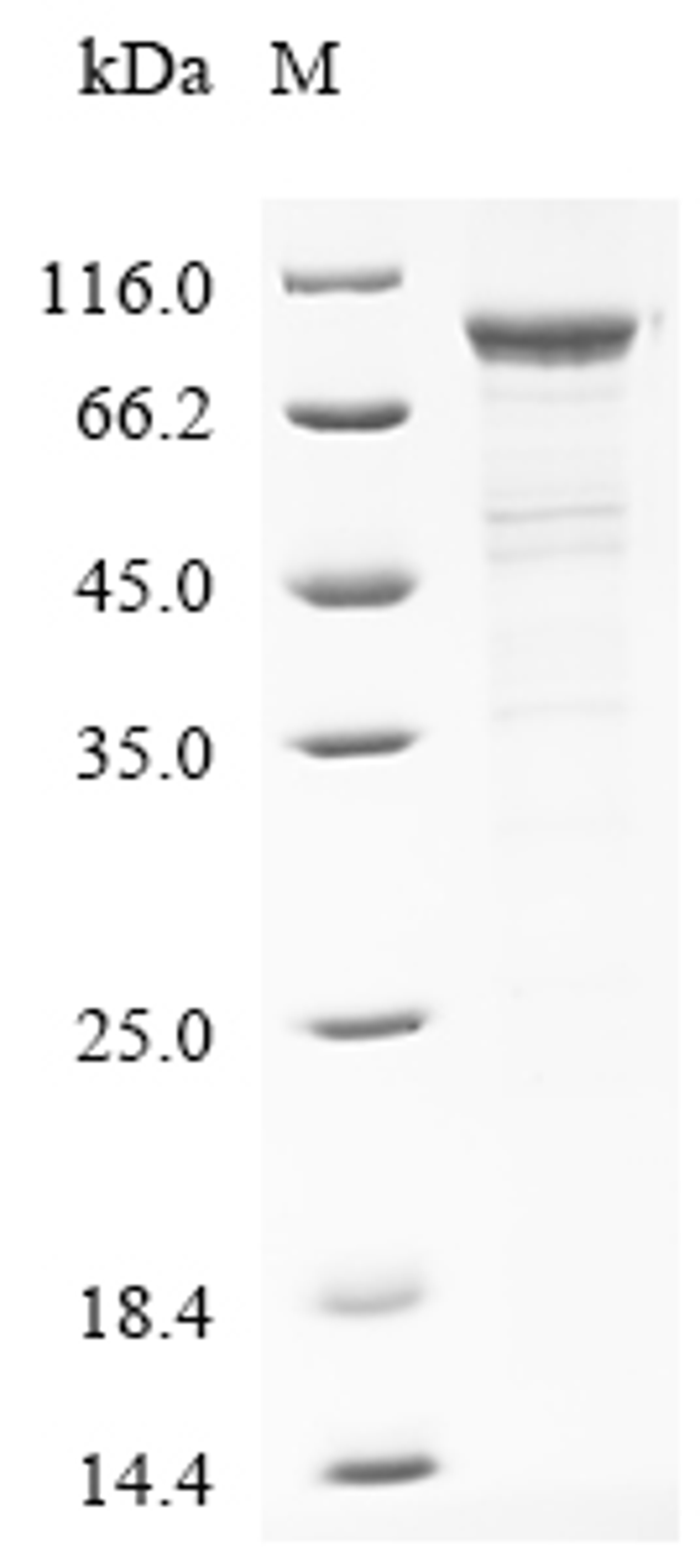 (Tris-Glycine gel) Discontinuous SDS-PAGE (reduced) with 5% enrichment gel and 15% separation gel.