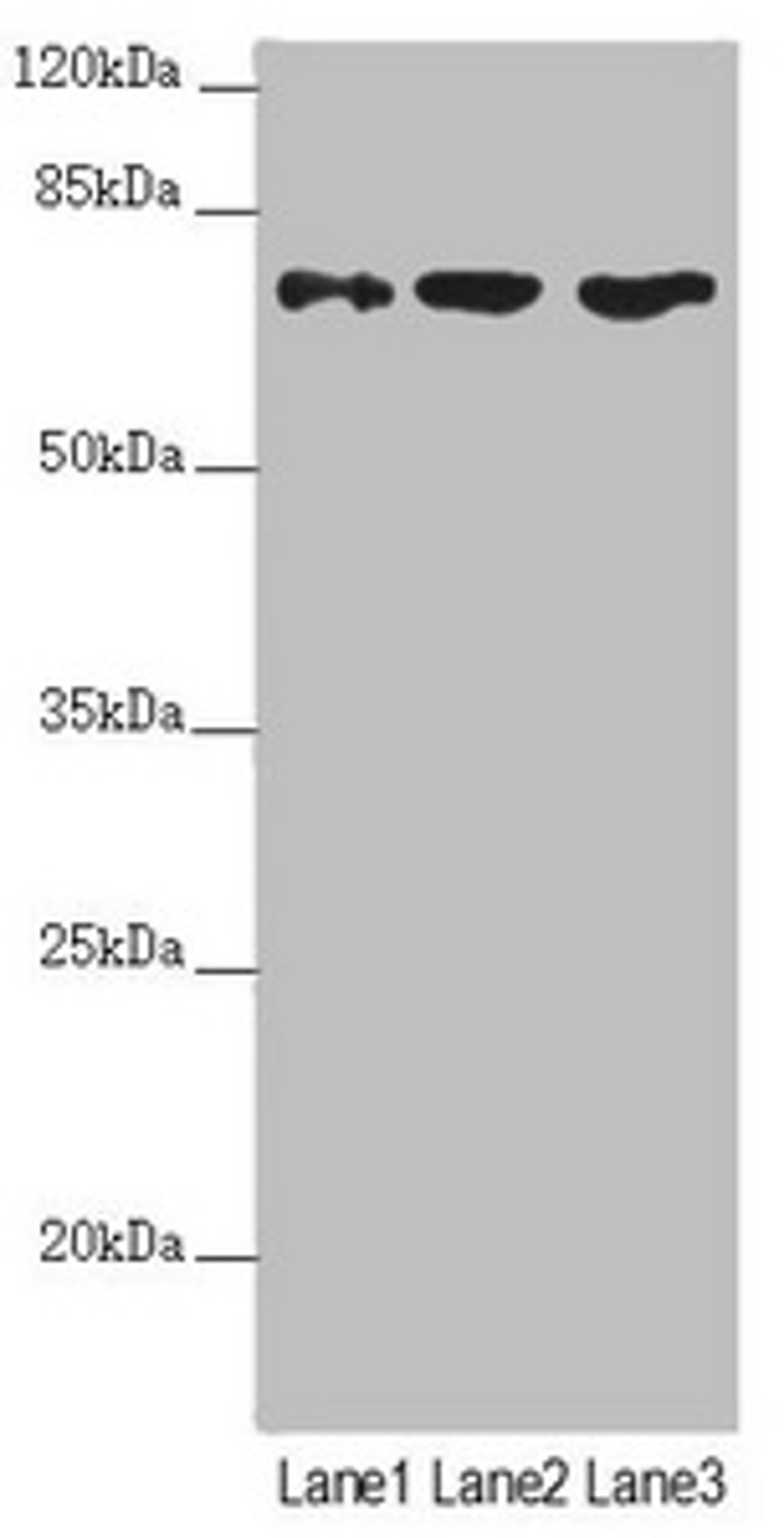 Western blot. All lanes: SCFD1 antibody at 4.48µg/ml. Lane 1: Mouse liver tissue. Lane 2: Hela whole cell lysate. Lane 3: A549 whole cell lysate. Secondary. Goat polyclonal to rabbit IgG at 1/10000 dilution. Predicted band size: 73, 63, 66 kDa. Observed band size: 73 kDa