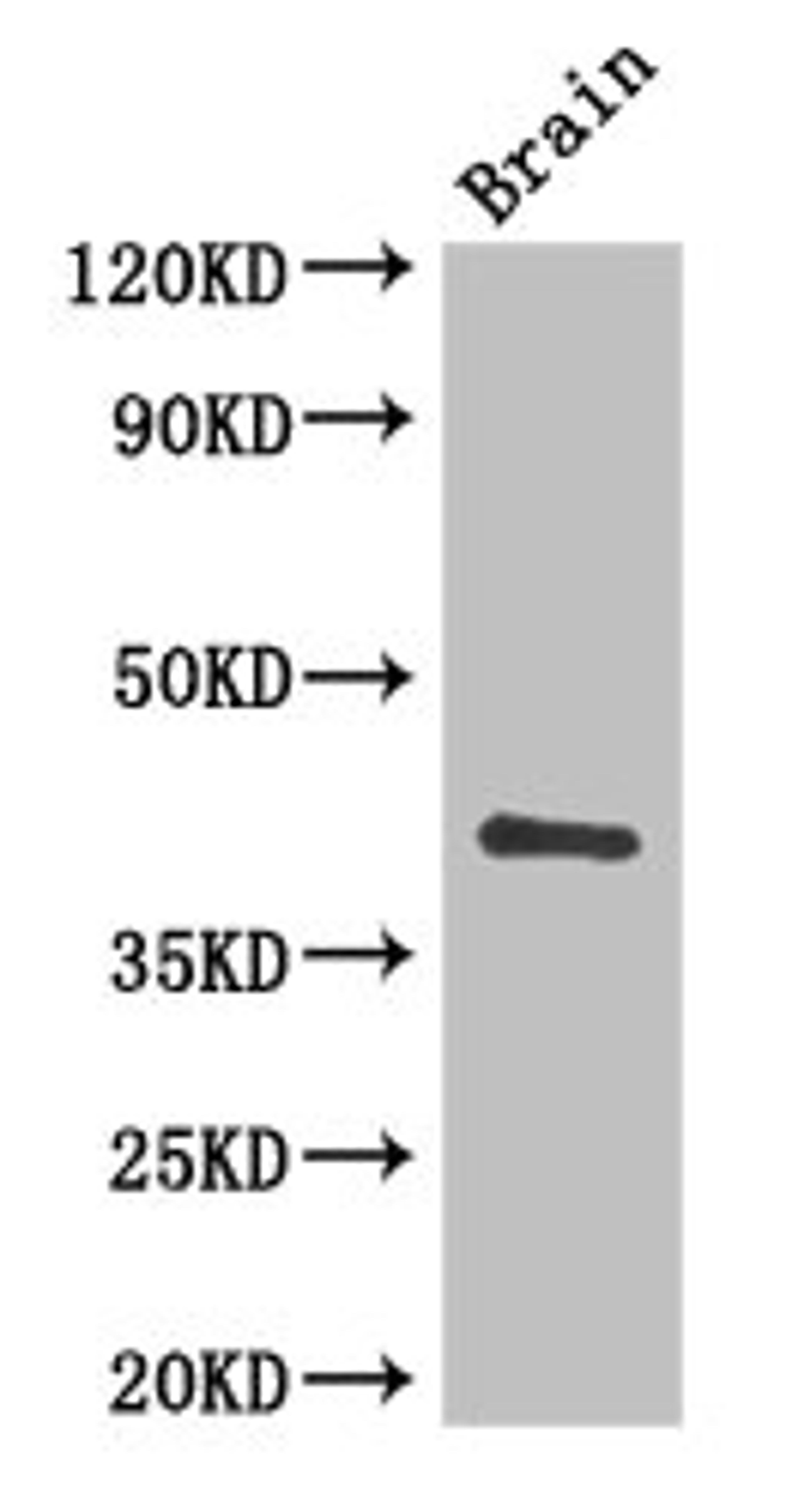 Western Blot. Positive WB detected in: Mouse brain tissue. All lanes: CD34 antibody at 3ug/ml. Secondary. Goat polyclonal to rabbit IgG at 1/50000 dilution. Predicted band size: 41, 36 kDa. Observed band size: 41 kDa. 