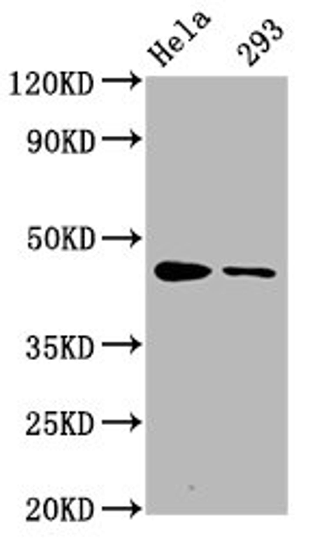 Western Blot. Positive WB detected in Hela whole cell lysate,293 whole cell lysate. All lanes Phospho-CREB1 antibody at 1.65μg/ml. Secondary. Goat polyclonal to rabbit IgG at 1/50000 dilution. Predicted band size: 46 KDa. Observed band size: 46 KDa.