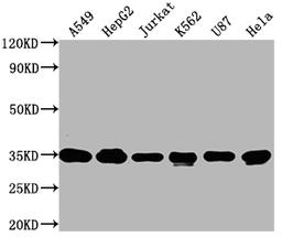 Western Blot. Positive WB detected in: A549 whole cell lysate, HepG2 whole cell lysate, Jurkat whole cell lysate, K562 whole cell lysate, U87 whole cell lysate, Hela whole cell lysate. All lanes: SUMF2 antibody at 1:2000. Secondary. Goat polyclonal to rabbit IgG at 1/50000 dilution. Predicted band size: 34, 25, 38, 24, 35 kDa. Observed band size: 34 kDa. 