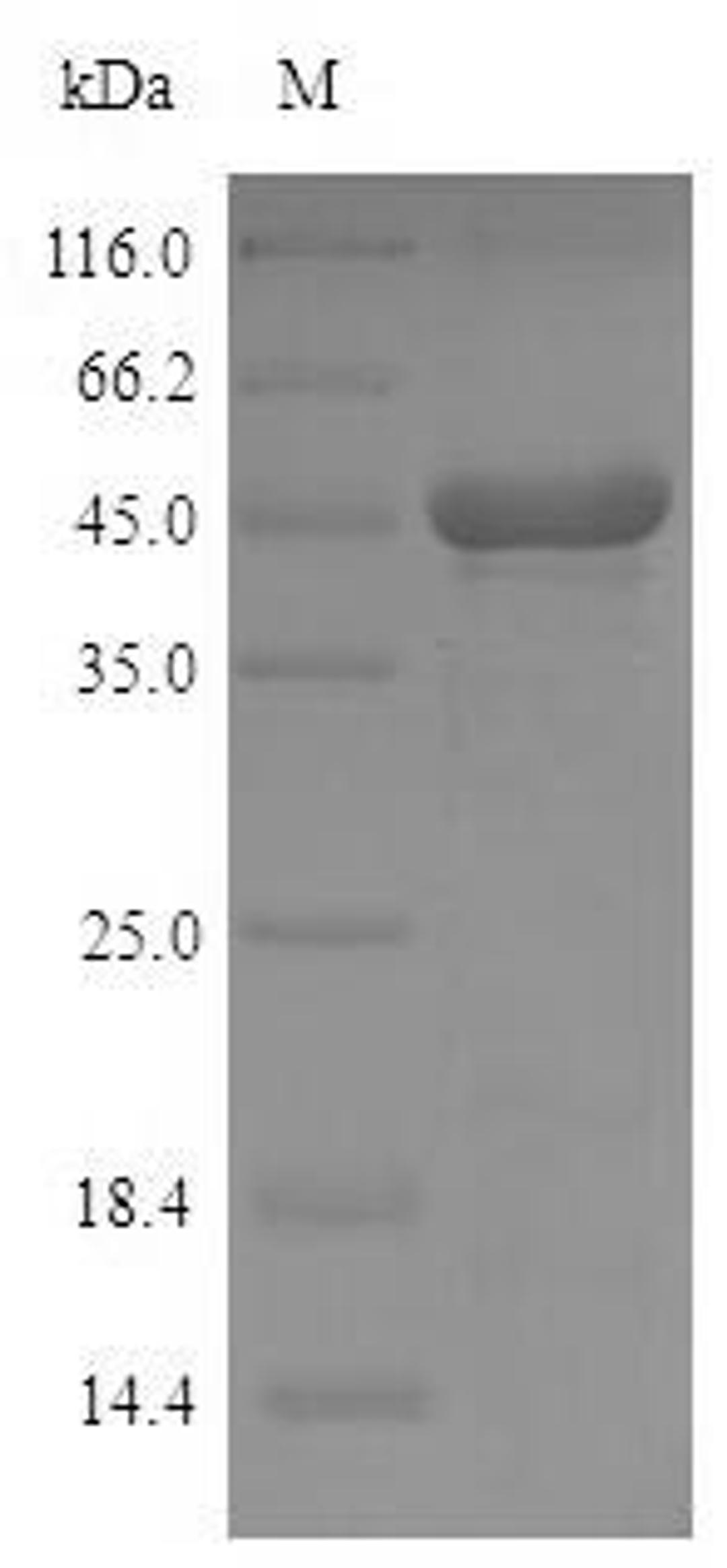 (Tris-Glycine gel) Discontinuous SDS-PAGE (reduced) with 5% enrichment gel and 15% separation gel.