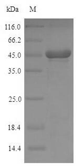 (Tris-Glycine gel) Discontinuous SDS-PAGE (reduced) with 5% enrichment gel and 15% separation gel.