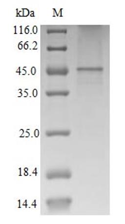 (Tris-Glycine gel) Discontinuous SDS-PAGE (reduced) with 5% enrichment gel and 15% separation gel.
