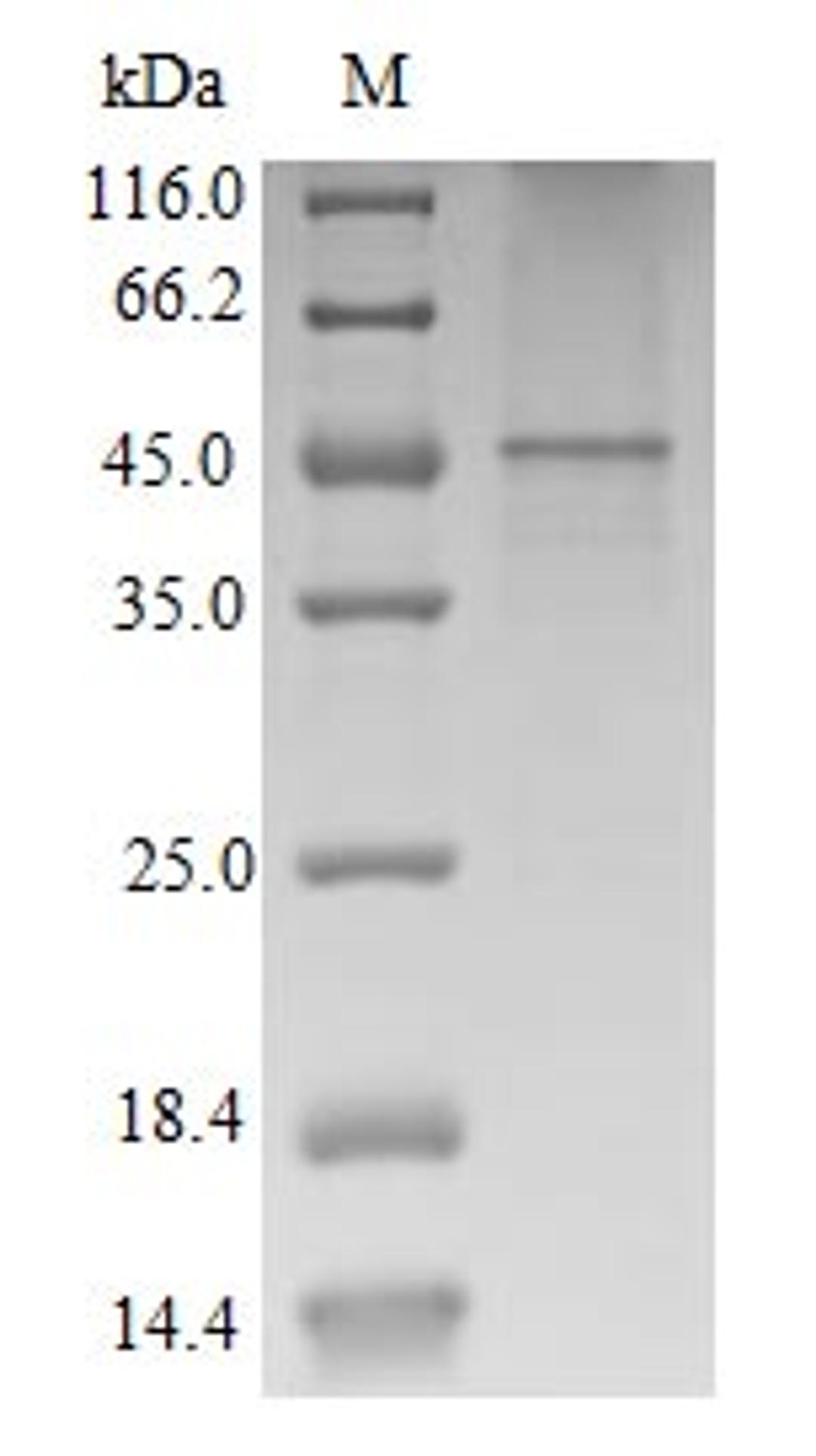 (Tris-Glycine gel) Discontinuous SDS-PAGE (reduced) with 5% enrichment gel and 15% separation gel.