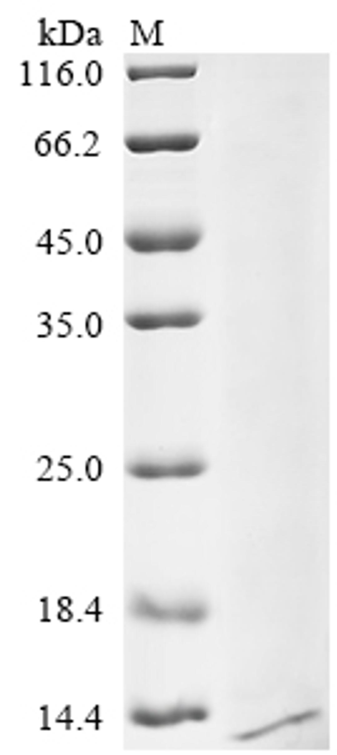 (Tris-Glycine gel) Discontinuous SDS-PAGE (reduced) with 5% enrichment gel and 15% separation gel.