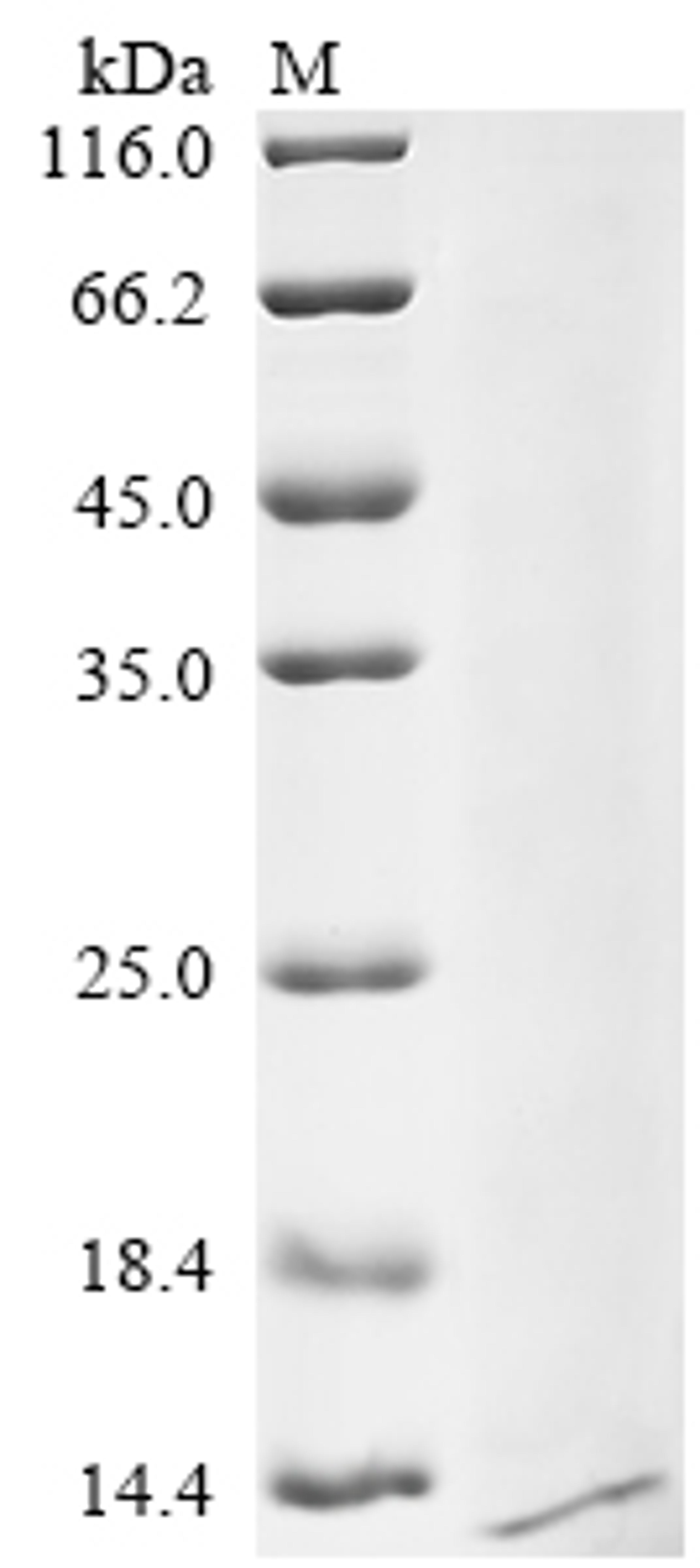 (Tris-Glycine gel) Discontinuous SDS-PAGE (reduced) with 5% enrichment gel and 15% separation gel.
