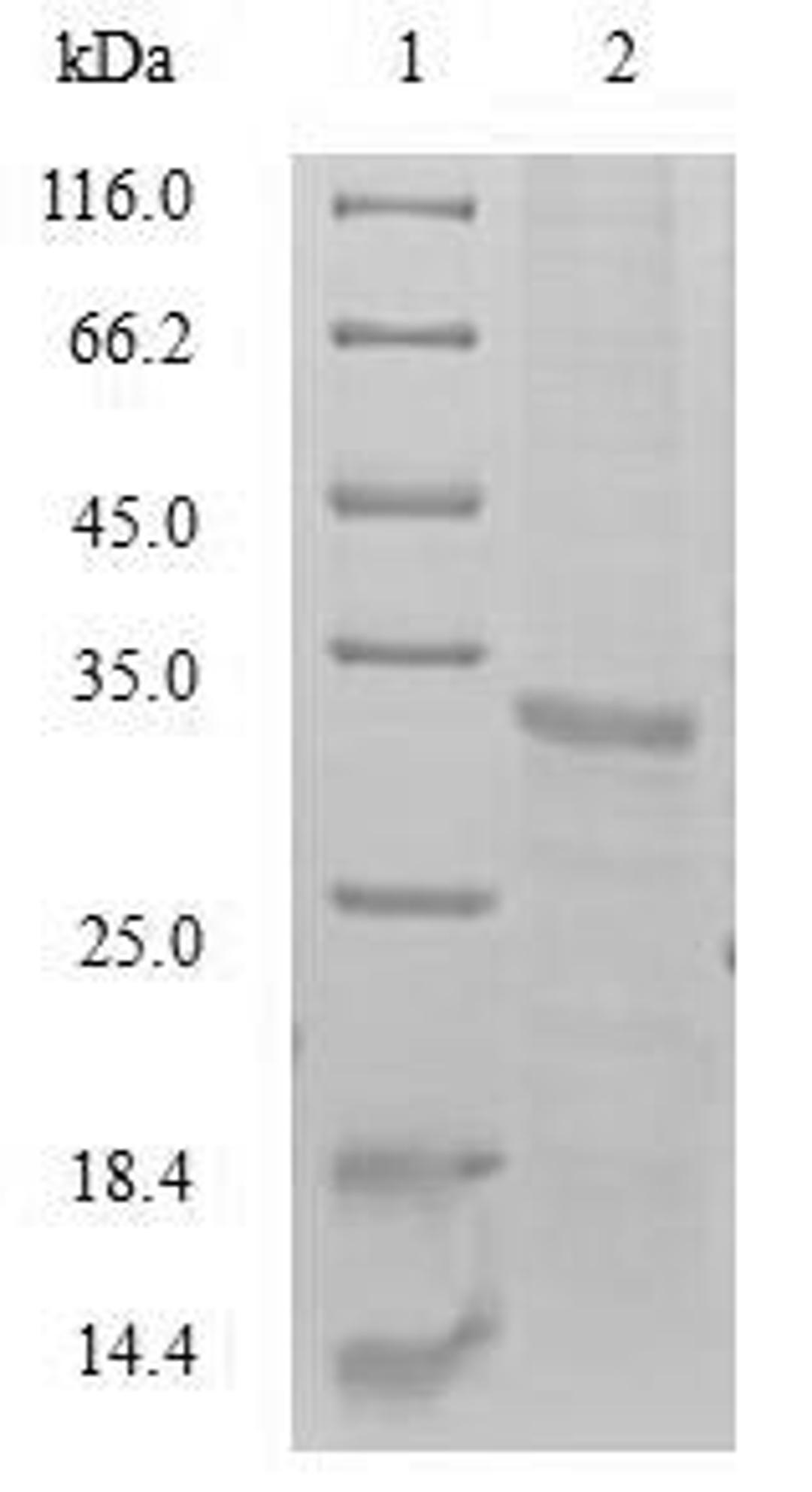 (Tris-Glycine gel) Discontinuous SDS-PAGE (reduced) with 5% enrichment gel and 15% separation gel.